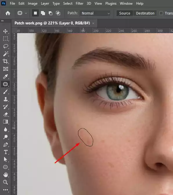 Draw a selection around the imperfection