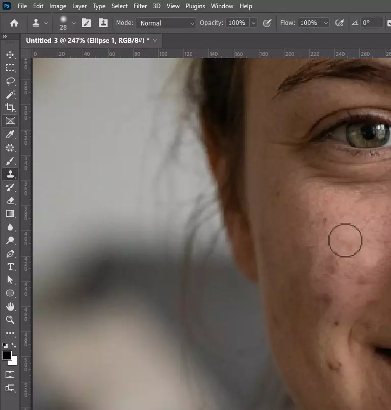 Sample a clean skin area