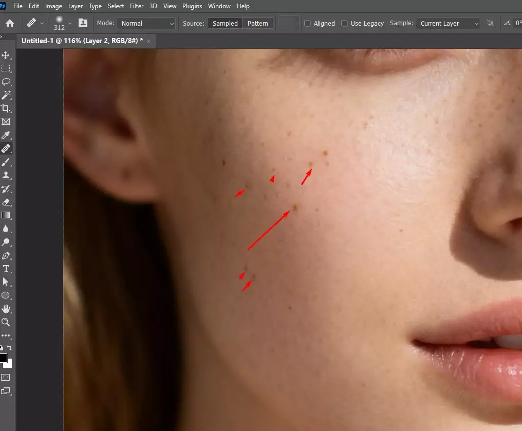 Sample a clean skin area